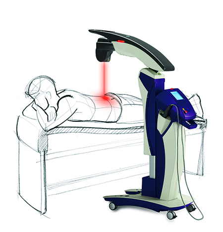 MLS ROBOTIC LASER THERAPY
